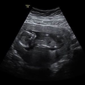 Meet your Posher, Leighann